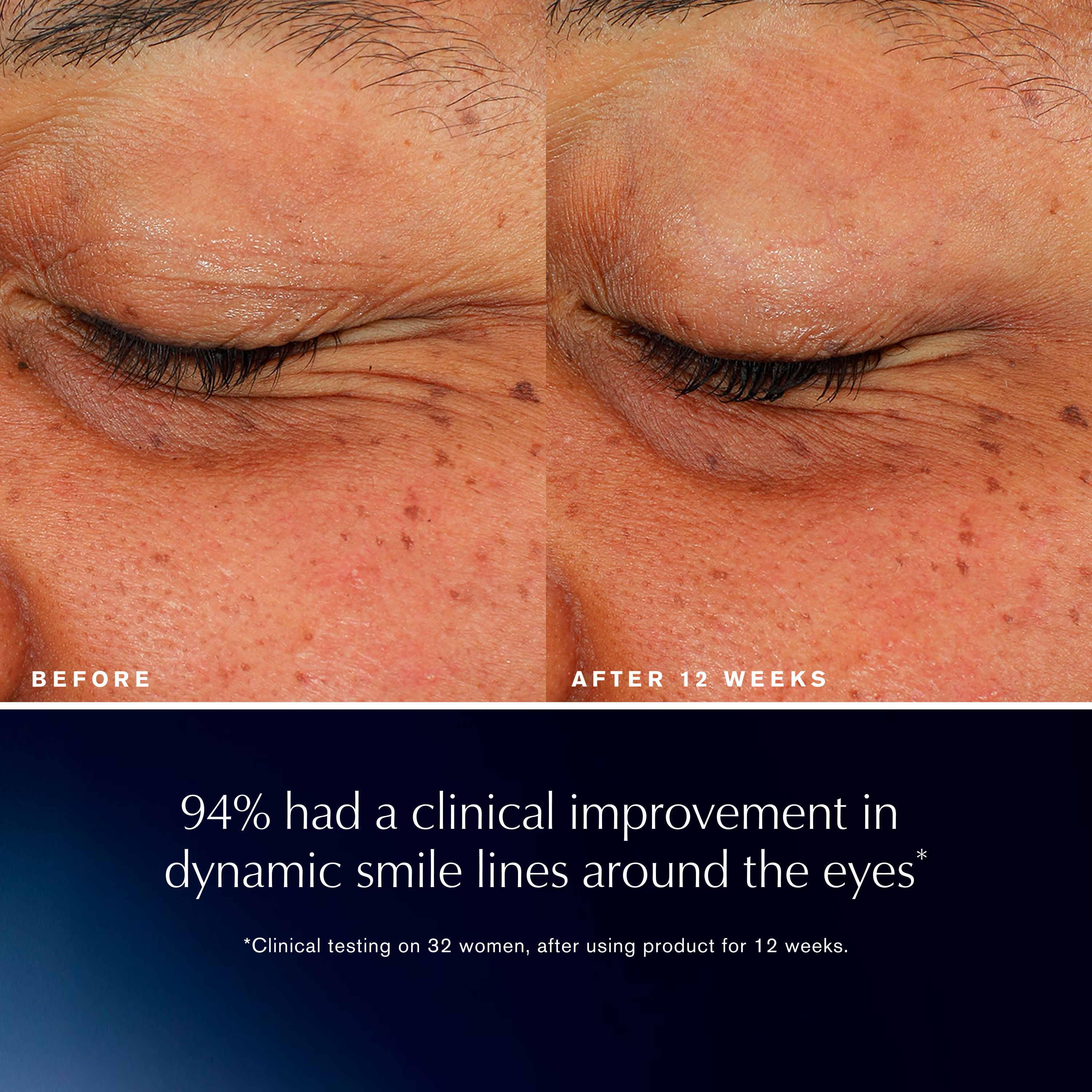 Estée Lauder Advanced Night Repair Eye Lift – view 5